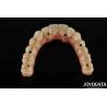Buy cheap Custom Titanium Malong Dental Hybrid Bridge Corrosion Resistance Adjustable from wholesalers
