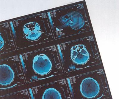 Quality Digital Medical X Ray Dry Film Thermal For Hospital CR / DR for sale
