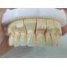 Buy cheap Dental Product Zirconia Layered With Porcelain Easy Maintenance from wholesalers