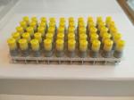 High Strength Dental Filling Material Amalgam Alloy Capsule 43%Ag 32%Sn 25%Cu