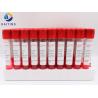 Buy cheap Mycoplasma Ureaplasma Blood Sample Test Tubes 4ml from wholesalers
