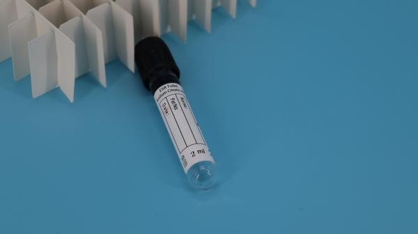 Buy cheap Vacuette Evacuated Blood Sample Centrifuge Tube For Medical Laboratory from wholesalers