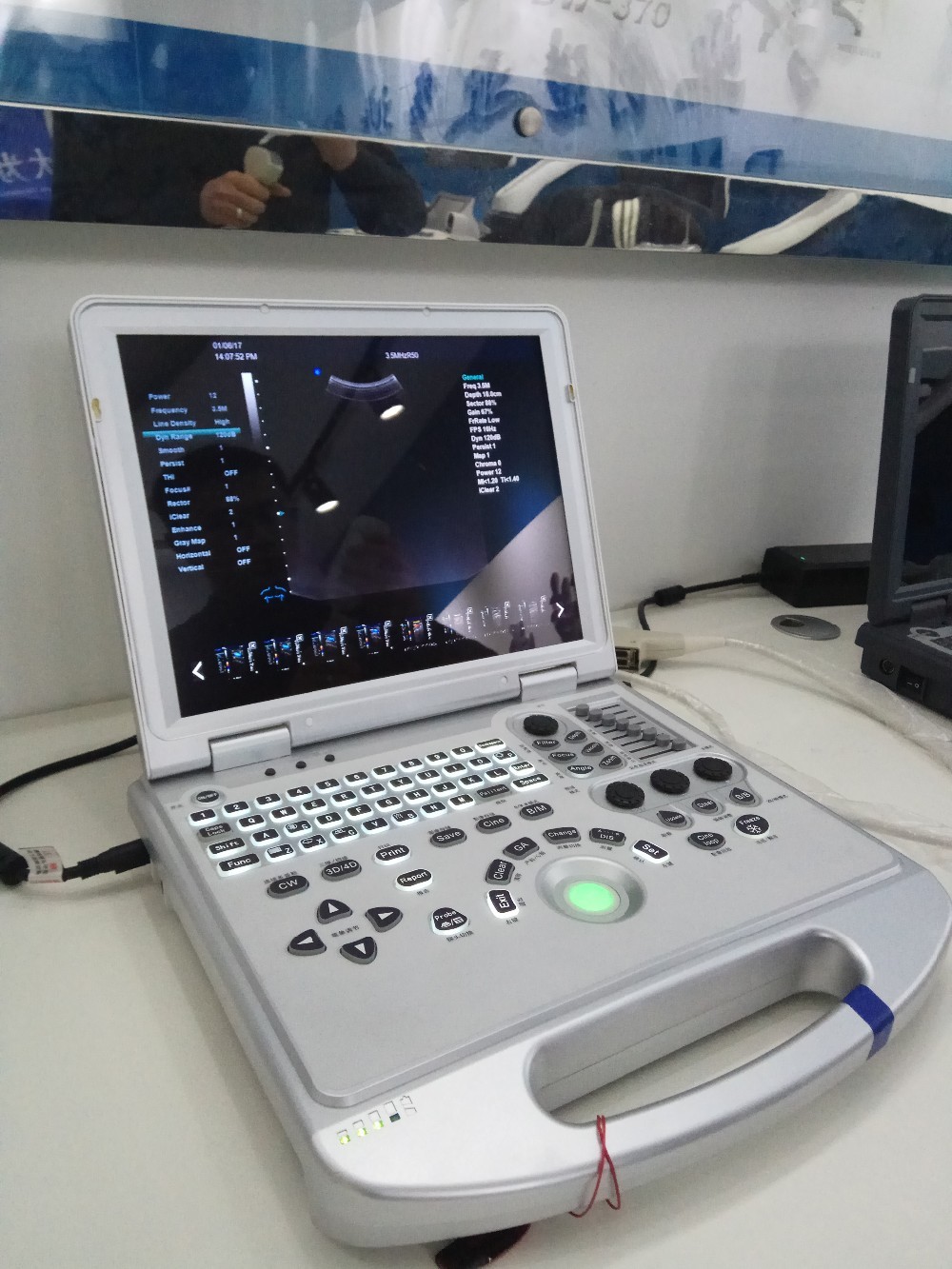 GH 4D Color Doppler Portable Ultrasound Device GH-P6