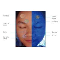 Buy cheap 45W Power Smart Skin Analyzer Machine PDF Print for Doctor Beauty Salon product