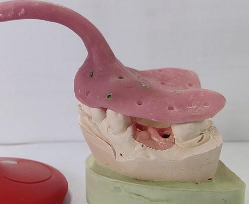Buy cheap Custom Denture Impression Trays from wholesalers