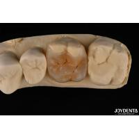 Buy cheap Custom Compound Inlay Onlay For Minimally Invasive Dental Restoration product