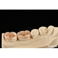 Buy cheap Natural Looking Composite Inlay Onlay Dental Restoration With Natural Appearance product