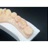 Buy cheap Emax Ceramic Inlays Onlays Dental Restorations For Natural Tooth Color And Easy Maintenance from wholesalers