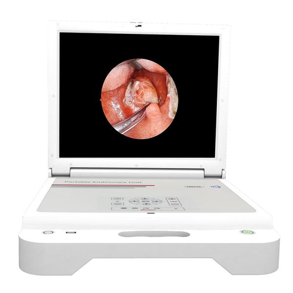 Buy cheap Gynecology ENT Portable Endoscope Camera 17" Mobile from wholesalers