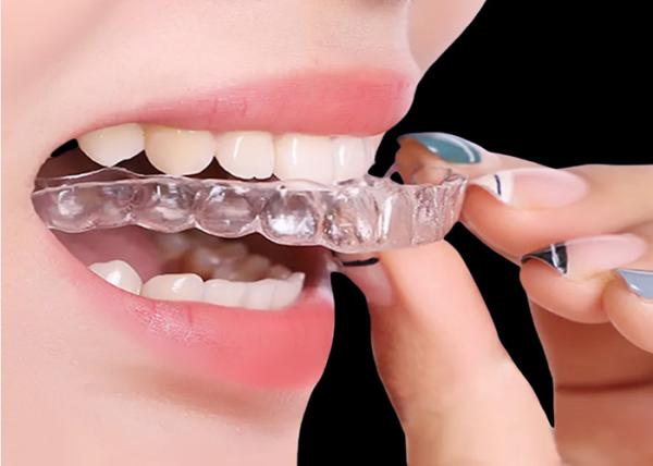 Buy cheap Invisible retainer Orthodontic Appliances For Quick Effective Treatment from wholesalers