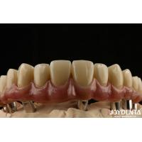 Buy cheap Titanium Malong Dental Hybrid Bridge Long Lasting Adjusted Fit Low Density product