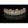 Buy cheap Precise Dental Implants Crowns And Bridges Custom Abutment from wholesalers