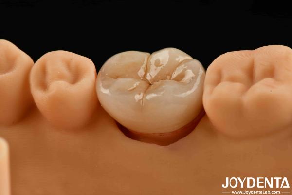 Buy cheap Natural-looking Multilayer Full Zirconia For High Strength And Durability from wholesalers