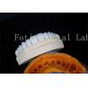 Buy cheap Porcelain Dental Lab Veneers Bonding Cement For Long Lasting Restorations from wholesalers
