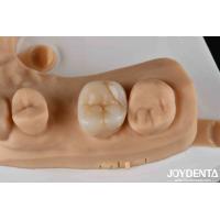 Buy cheap High Strength Zirconia Dental Inlays And Onlays For Tooth Restoration product