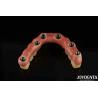 Buy cheap Low Density Titanium Malong Hybrid Bridge Dental Light Weight Comfortable Wear from wholesalers