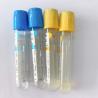Buy cheap Esr Citrate Blood Collecting Tube 8*120mm Micro SST Phlebotomy Tube from wholesalers