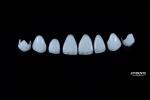 Natural Looking Emax Porcelain Veneer Comfortable Fit Ultra Thin Emax Veneers