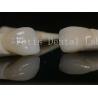 Buy cheap Long-lasting Dental Lab Laminate Veneers Customizable for Various Tooth Preparations from wholesalers