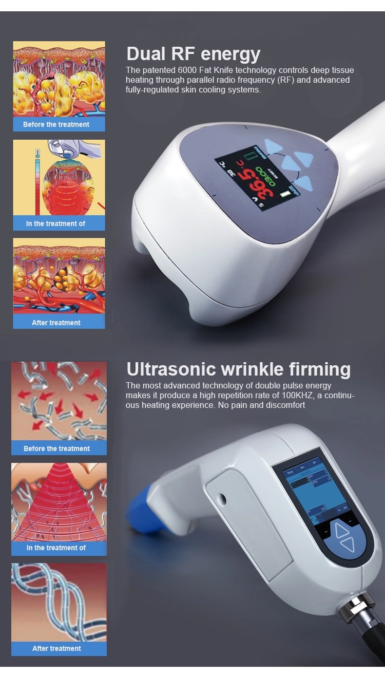 DS-35 Ultrasonic Radio Frequency Machines 300W Body Slimming Body Shaping