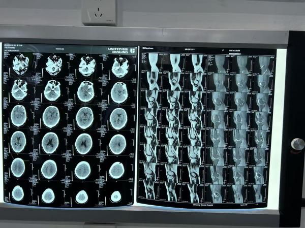 Buy cheap Density Enhanced Diagnostic Laser X Ray Film 0.28D For Medical Equipments from wholesalers