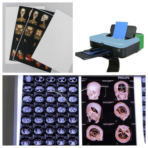 Buy cheap 9600x2400dpi Inkjet X Ray Film PET Blue Transparent For High Resolution Medical Imaging from wholesalers