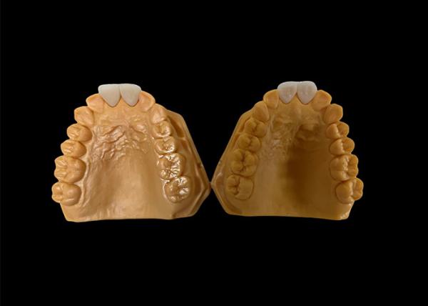 Buy cheap Customized Aesthetic Zirconia Dental Crown Perfectly Fitted for Anterior and Posterior Teeth from wholesalers