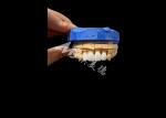 Unbeatable Strength Dental Zirconia Dentla Crown For Natural Looking Smiles