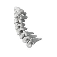 Buy cheap ISO PEEK Spinal Fusion Cage Degenerative Disc Disease Cervical Fusion Cage product