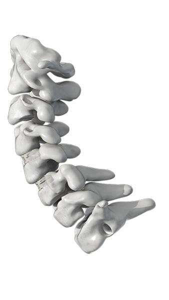 Buy cheap ISO PEEK Spinal Fusion Cage Degenerative Disc Disease Cervical Fusion Cage from wholesalers