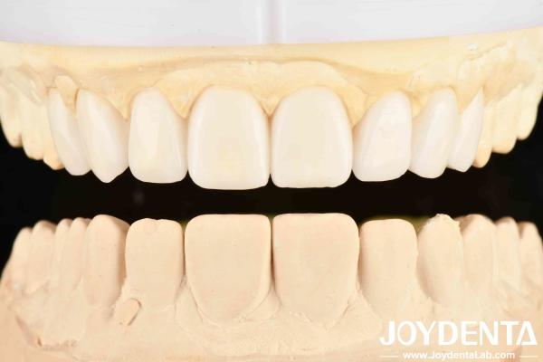 Buy cheap Experience the Difference with Dental's Good Elasticity and Tooth Arrangement Technology in Dental Care from wholesalers