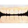 Buy cheap Dental's Good Elasticity And Tooth Arrangement Technology Flexible Denture Finish In Dental Care from wholesalers