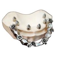 Buy cheap FDA 3014652903 PFM bridge dental Highly Aesthetic Extremely Strong product