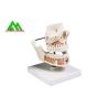 Buy cheap PVC Plastic Soft Gum Teeth Model , Dental Models For Teaching CE ISO from wholesalers