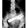 Buy cheap 11in x 14in X-ray Dry Medical Imaging Film Transparent KND-A For AGFA from wholesalers