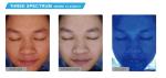 Pdf Print Portable Skin Analyzer Face Camera For Doctor Clinic