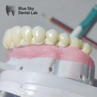 Buy cheap Pure Titanium Malo Implant Bridge Universal Metal Frame Malo Bridge product