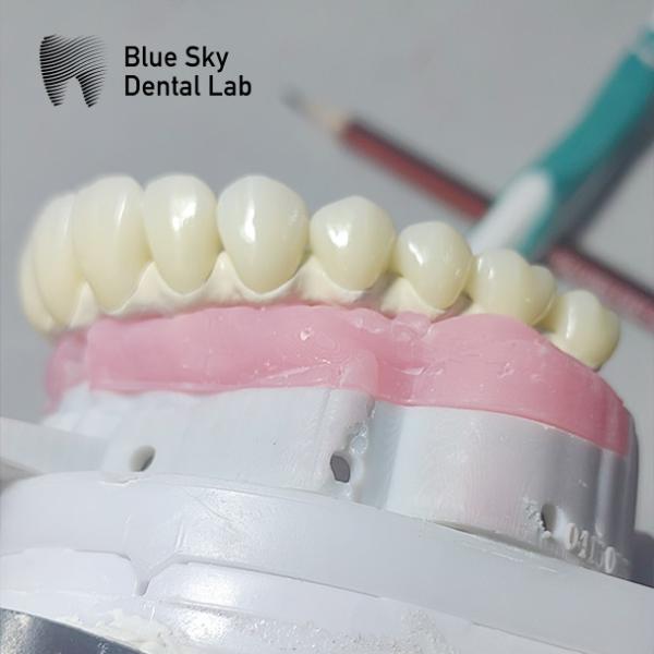 Buy cheap Pure Titanium Malo Implant Bridge Universal Metal Frame Malo Bridge from wholesalers