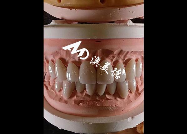 Buy cheap Cosmetic Dentistry EMAX Dental Veneers 0.3-0.5mm Thick For Esthetic Restorations from wholesalers