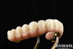 Durable Ti-Bar Zirconia Hybrid Bridge Made Of Titanium And Zirconia Materials
