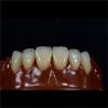 Buy cheap Tooth Multi Layered Zirconia Crown for Restorative Dentistry from wholesalers