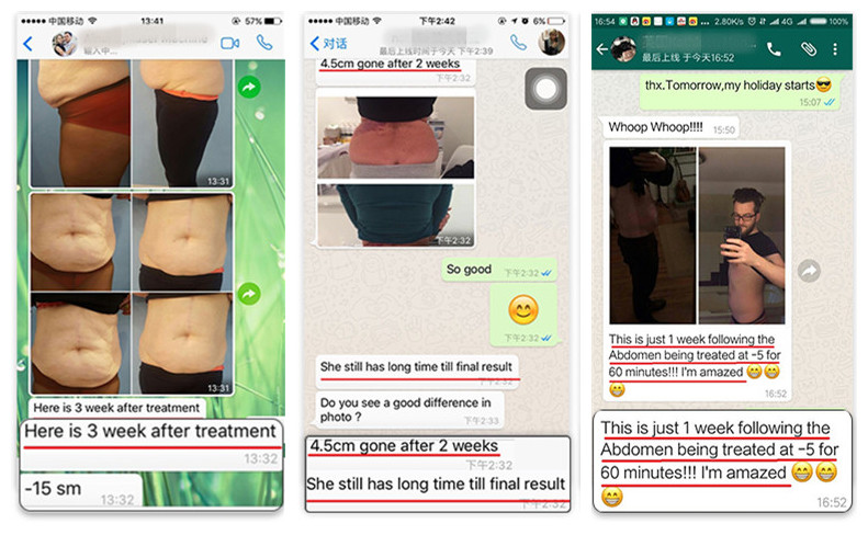 2018 newest freeze fat body slimming 4 handles cryolipolysis 