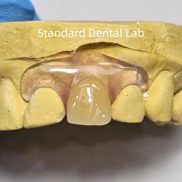Buy cheap Dental TCS Valplast Flexible Partial Dentures Staining Fading Odors Resistant from wholesalers