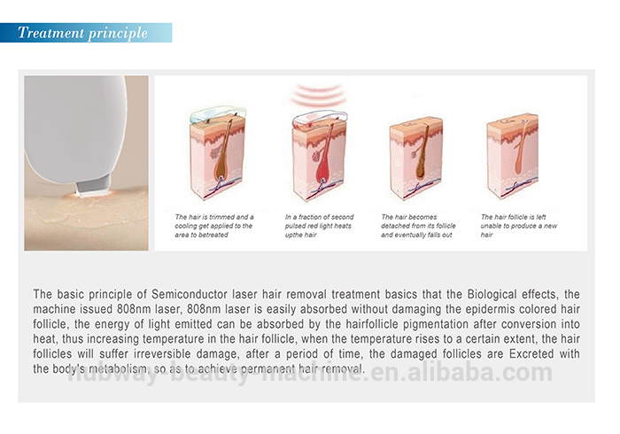 808 diode laser