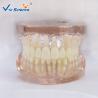 Buy cheap Peridontal Disease Teeth Study Model Human Dental Model Gingival Diseases from wholesalers