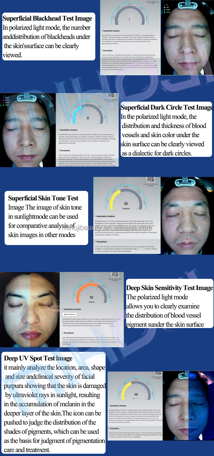 Moisture And Acne 3D Face Skin Analysis Machine with 36 Million Pixels Camera