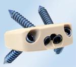 Orthopedic Peek Cage Cervical , Lumbar Cage Interbody Fusion Device Burlywood