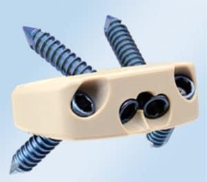 Buy cheap Orthopedic Peek Cage Cervical , Lumbar Cage Interbody Fusion Device Burlywood Color from wholesalers