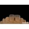 Buy cheap Eco Friendly Micro Dental Teeth Veneer 0.2mm Thickness Smooth Texture from wholesalers