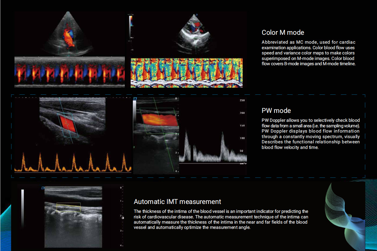 Portable Color Doppler Ultrasound Device Medical Diagnostic Machine GH-P8lite